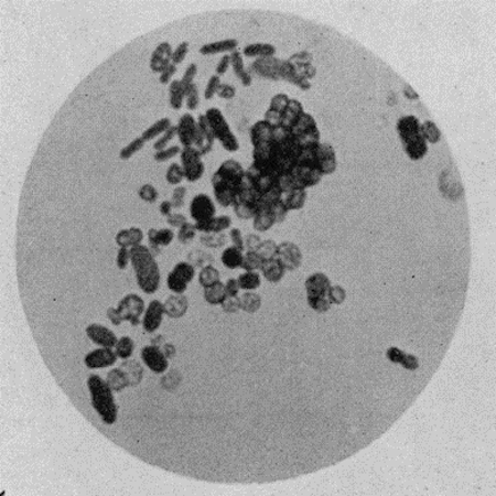 Microscopic image of Azotobacter